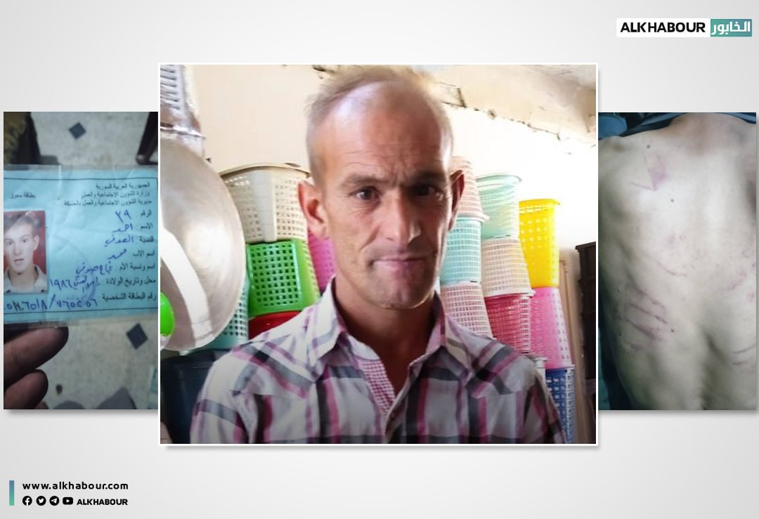 الشرطة المدنية تعتـدي بالضرب على معاق عقلي في رأس العين